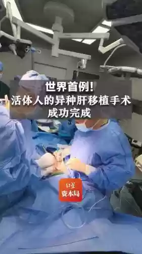 现在科技能移植什么器官插图1