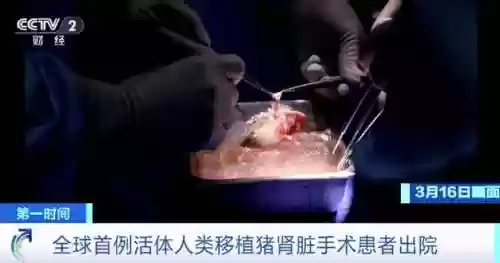 现在科技能移植什么器官插图