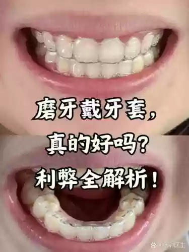 磨牙套技能插图
